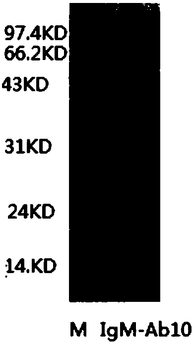 Anti-human IgM monoclonal antibody, hybridoma cell strain and application thereof