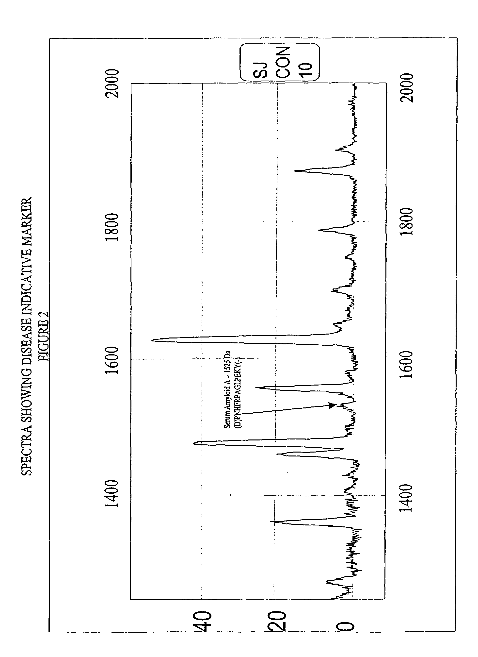 Biopolymer marker indicative of disease state having a molecular weight of 1525 Daltons