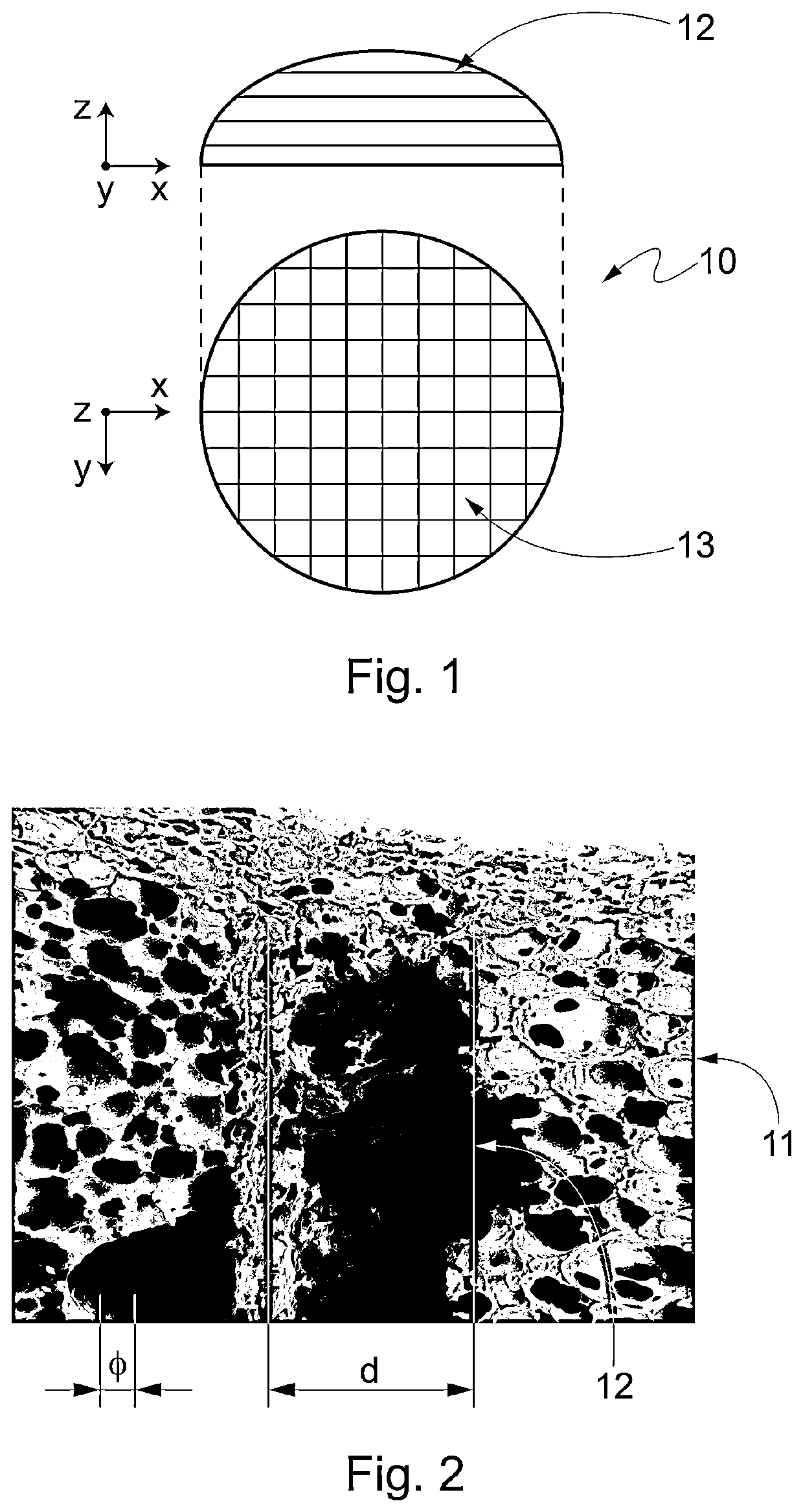 Biodegradable medical device for breast reconstruction and/or augmentation