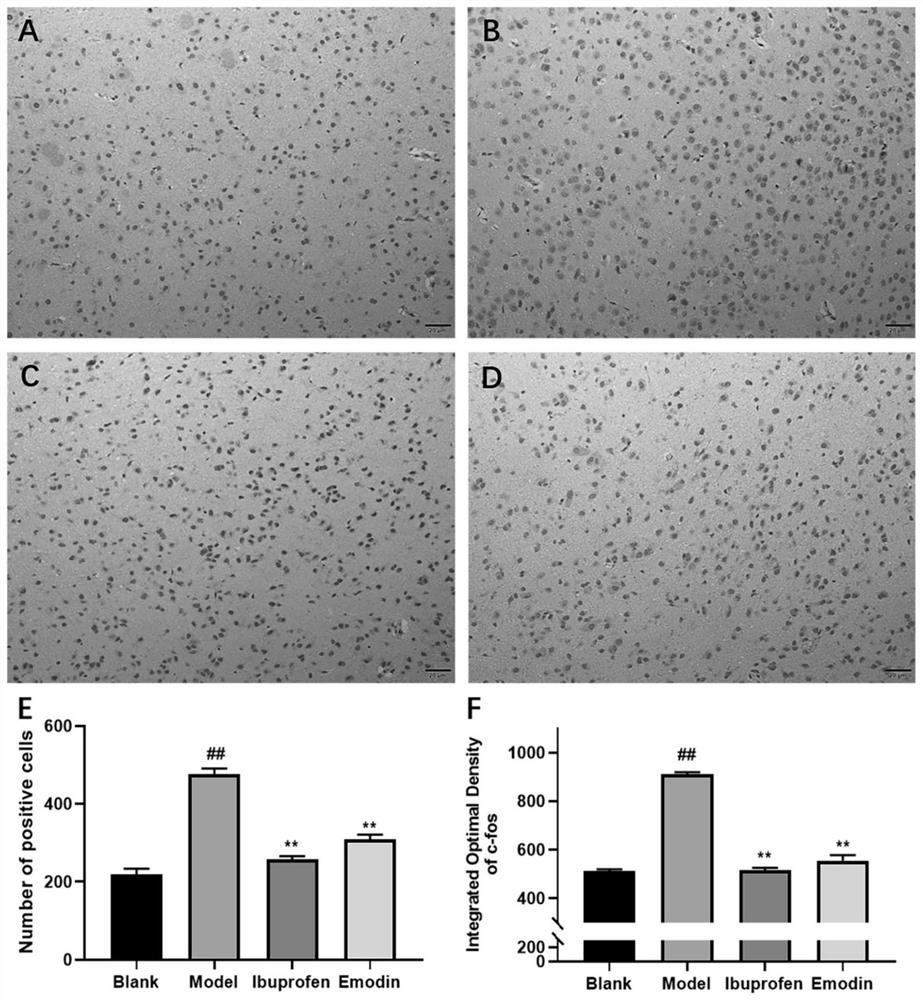 Application of emodin in preparation of medicine for treating migraine