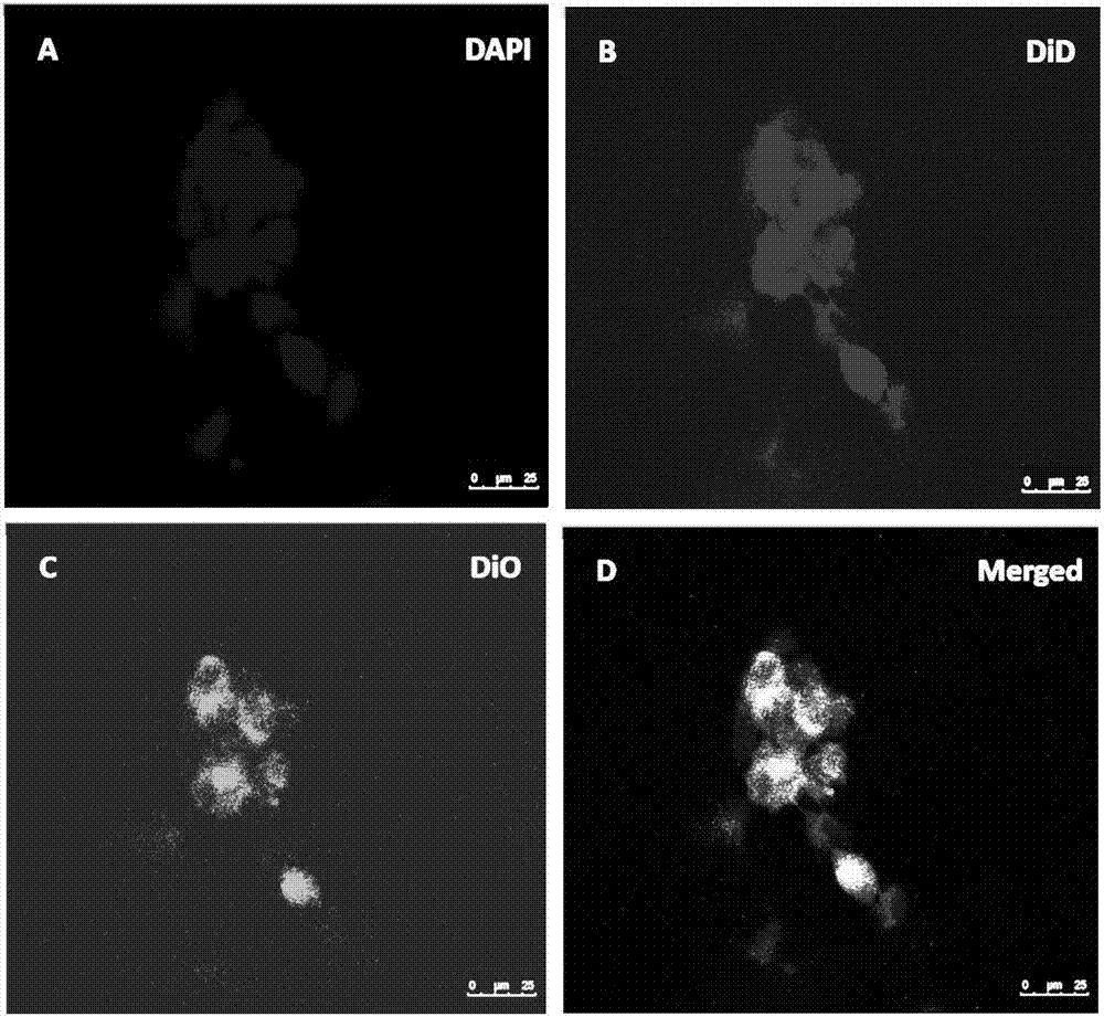 Red cell membrane encapsulated polyester-type As2O3-supported nano particles and preparation method thereof