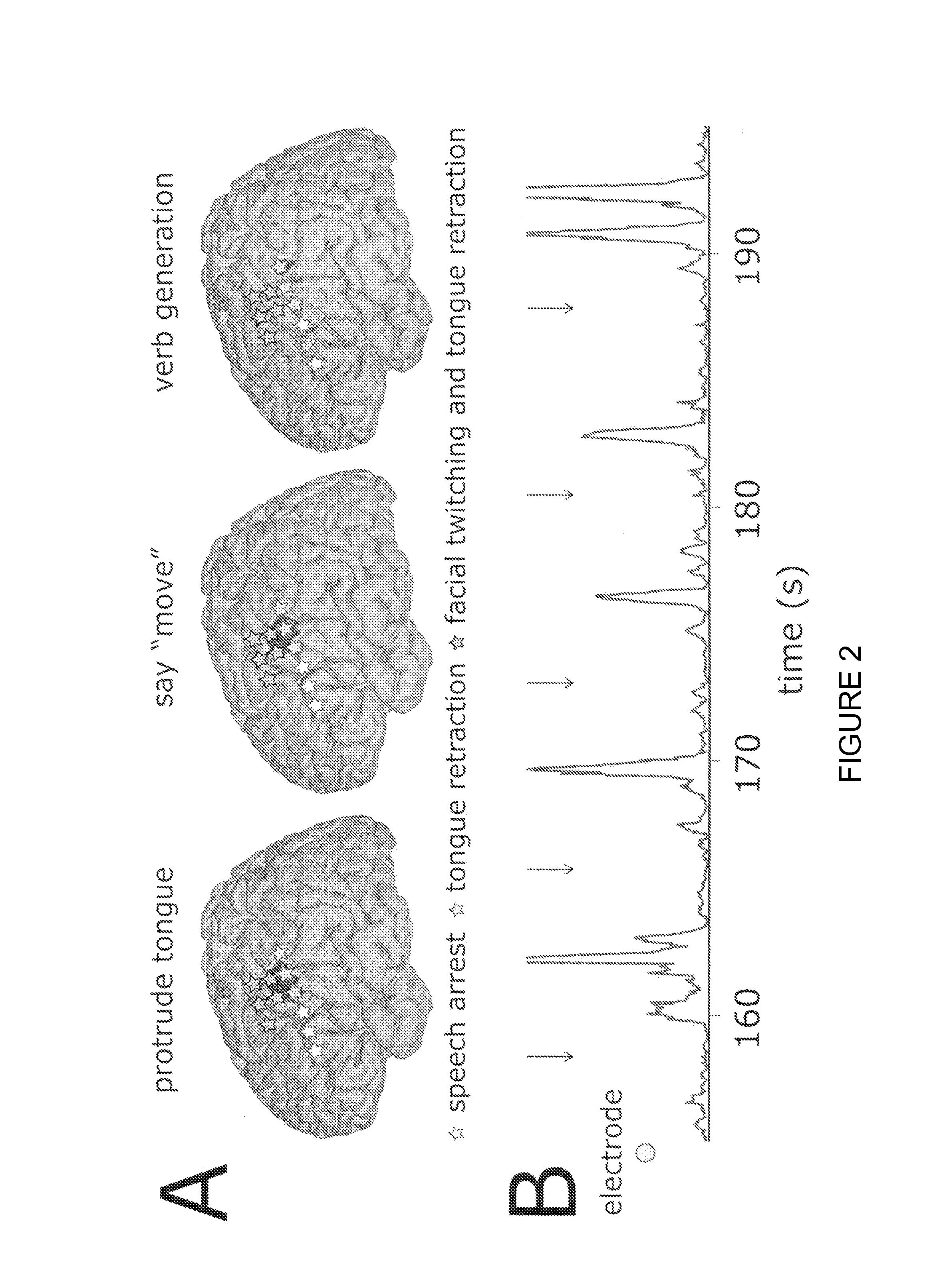 Method for analyzing function of the brain and other complex systems