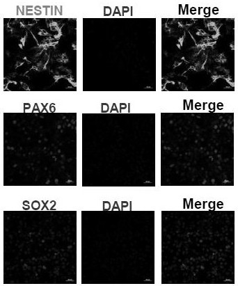 Preparation method and application of oligodendroglia cells