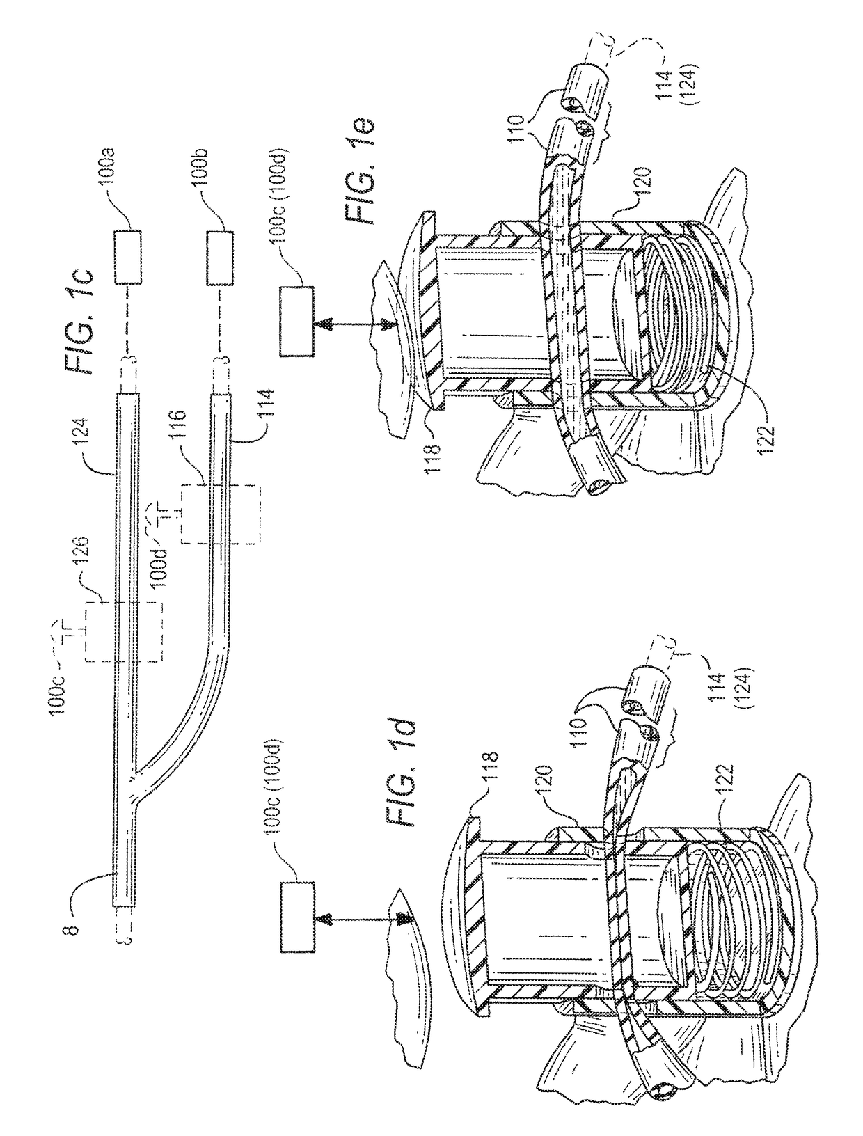 Endocranial endoscope