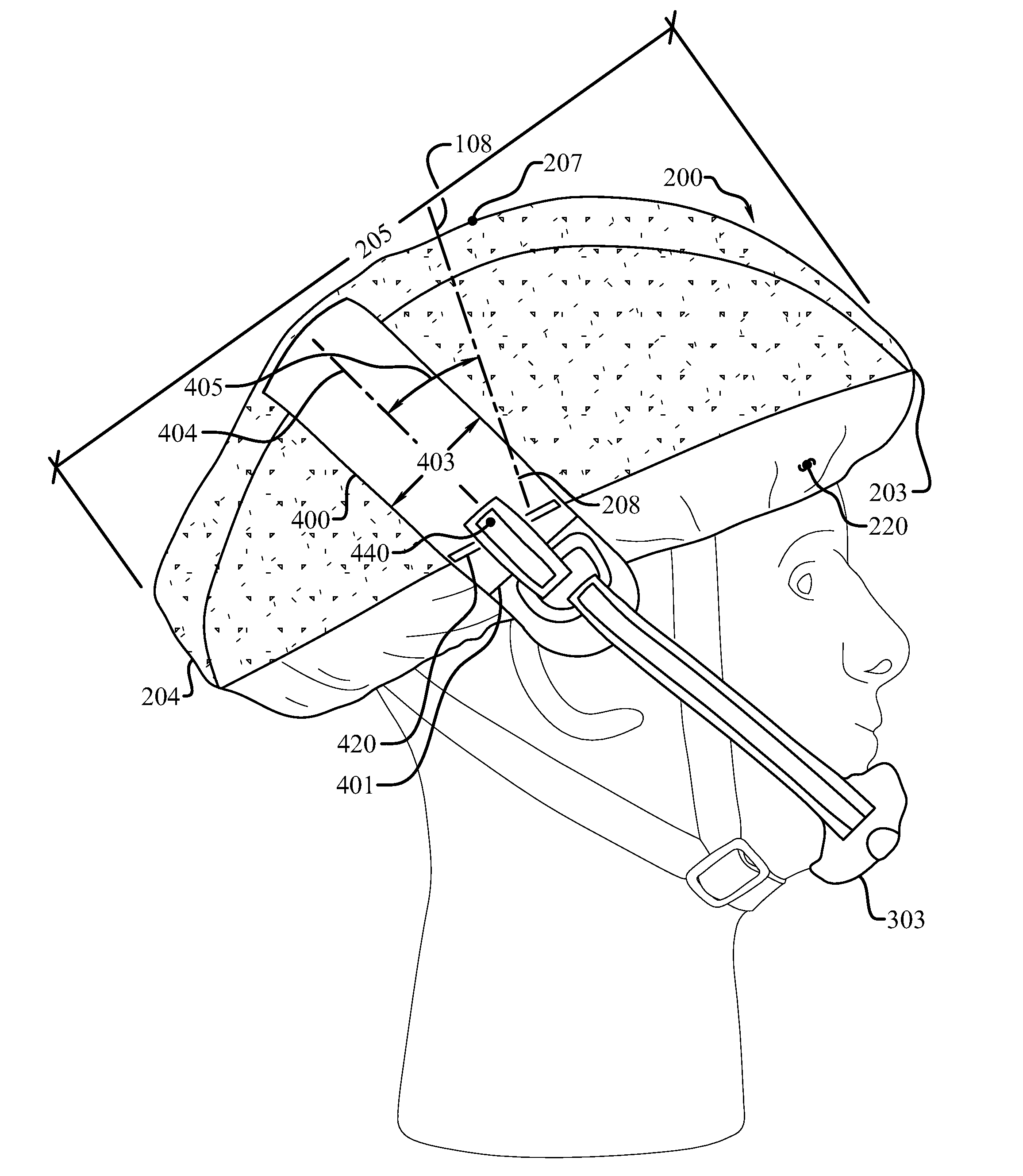 Chin protection system