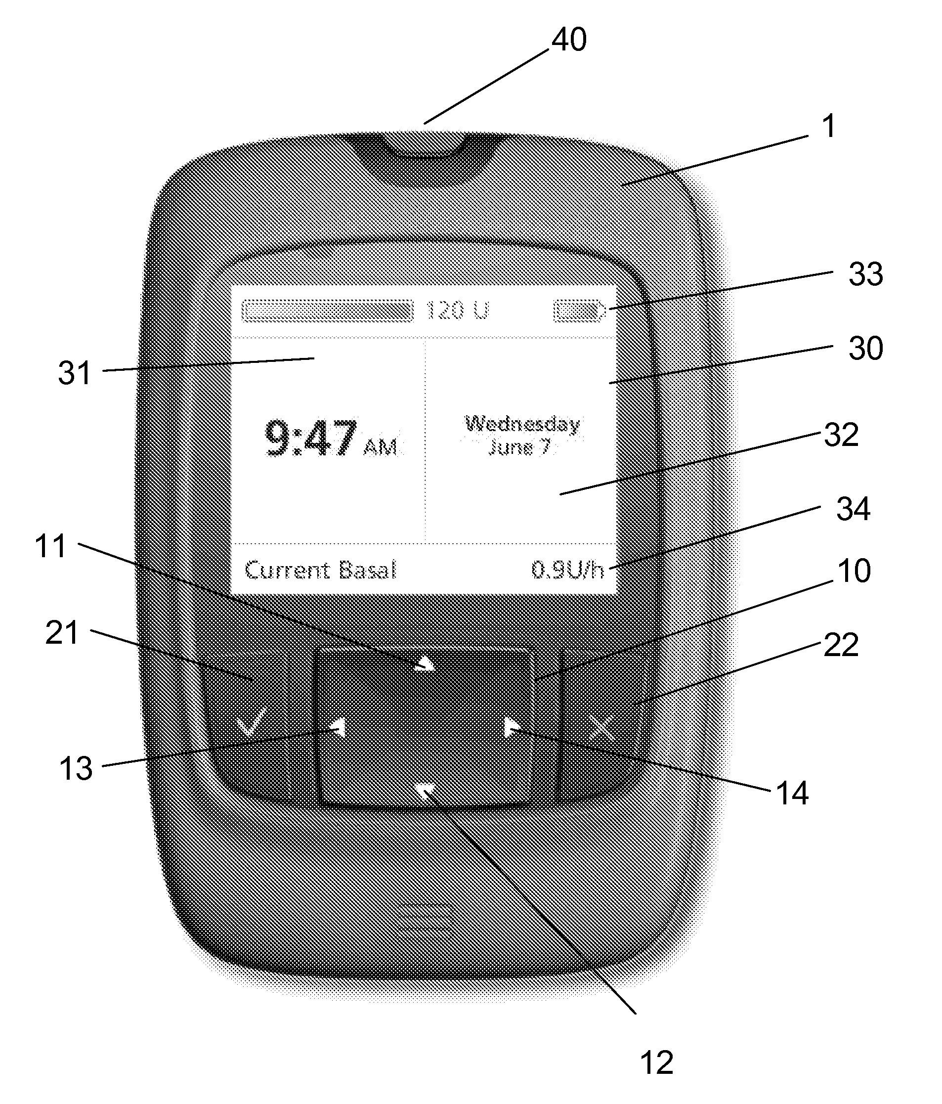 User interface for medical system comprising diary function with time change feature