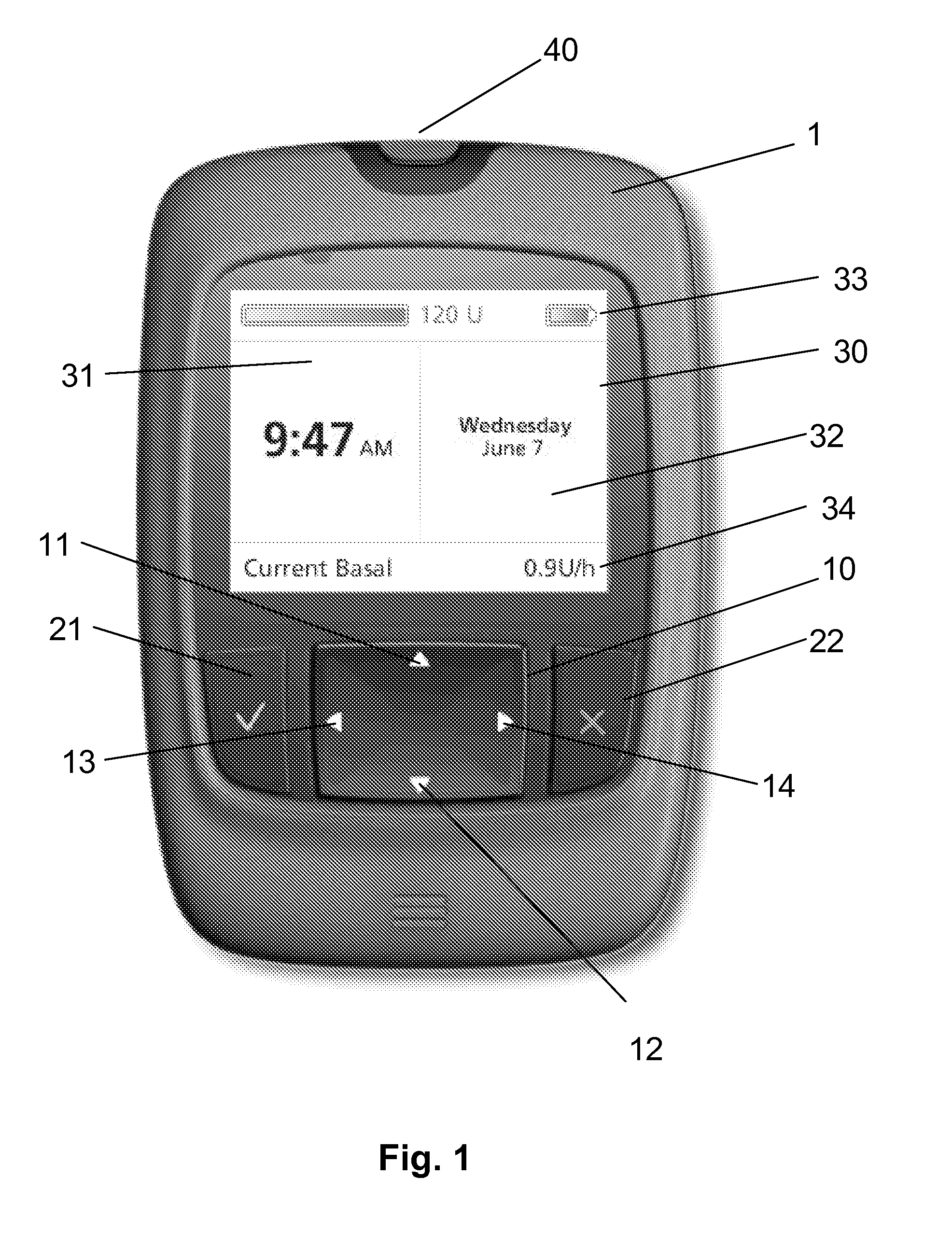 User interface for medical system comprising diary function with time change feature