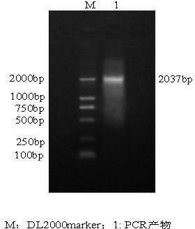 Intramuscular fat deposition fatty acid transport protein-1 (FATP-1) gene