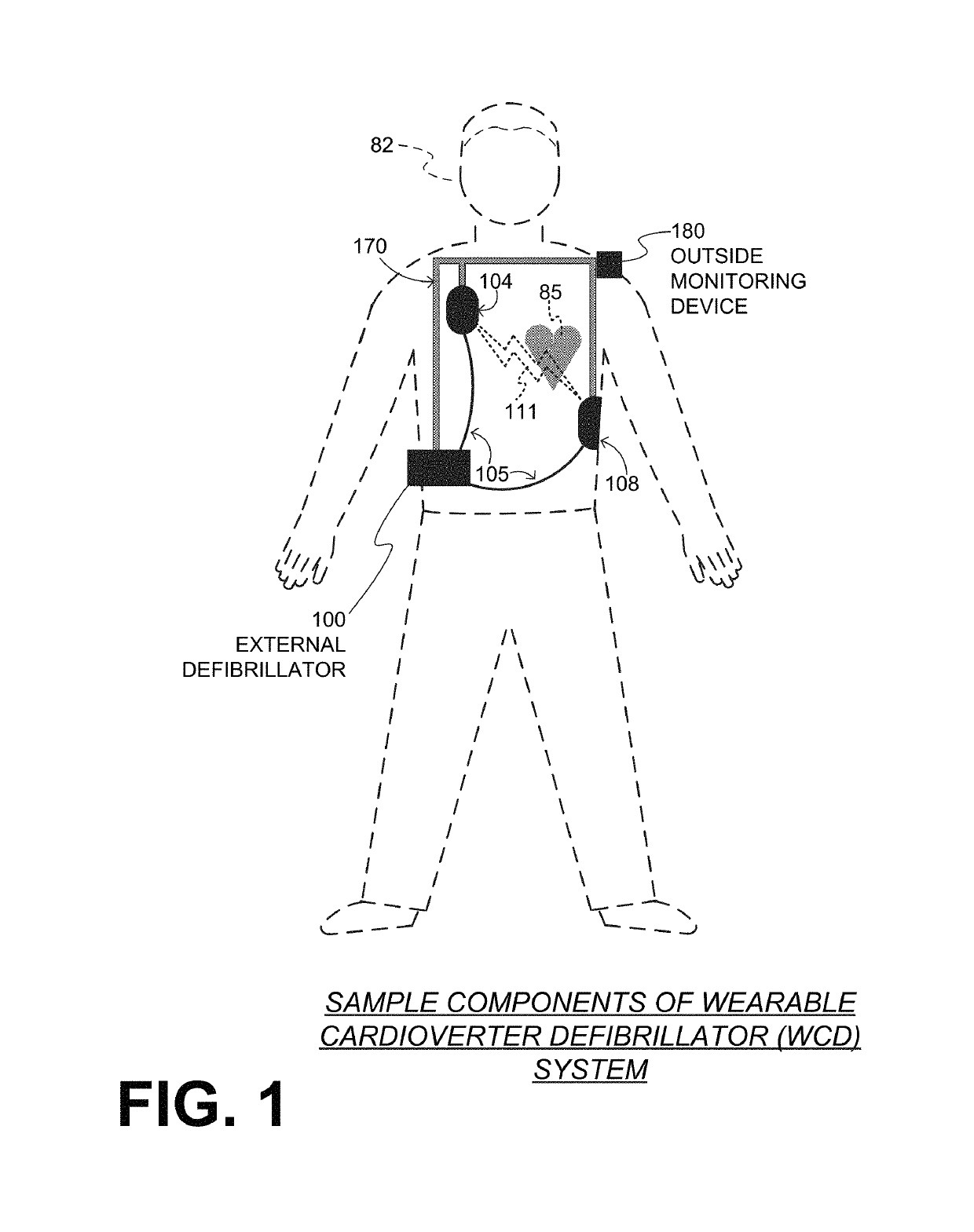 WCD system validating detected cardiac arrhythmias thoroughly so as to not sound loudly due to some quickly self-terminating cardiac arrhythmias