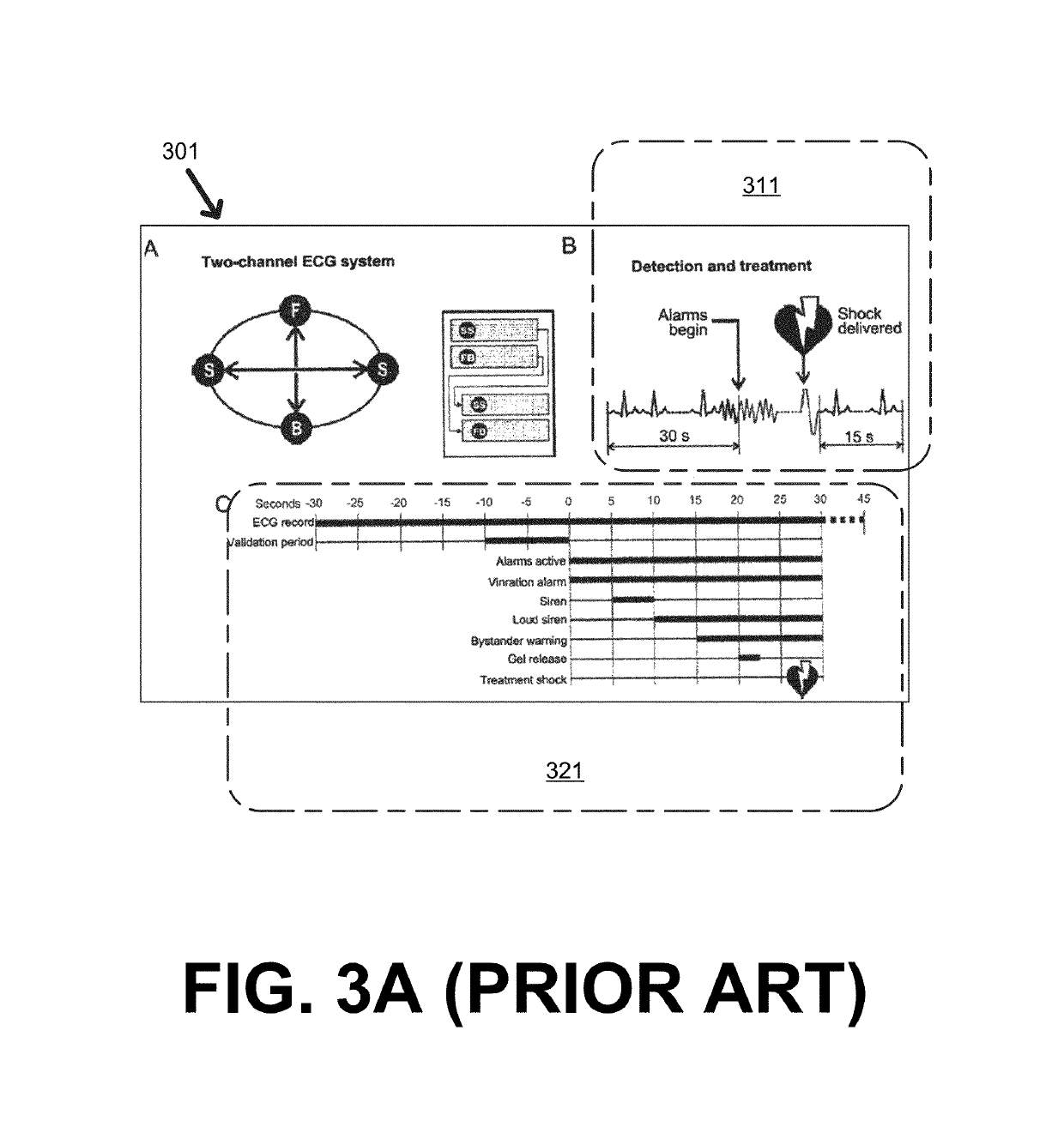 WCD system validating detected cardiac arrhythmias thoroughly so as to not sound loudly due to some quickly self-terminating cardiac arrhythmias