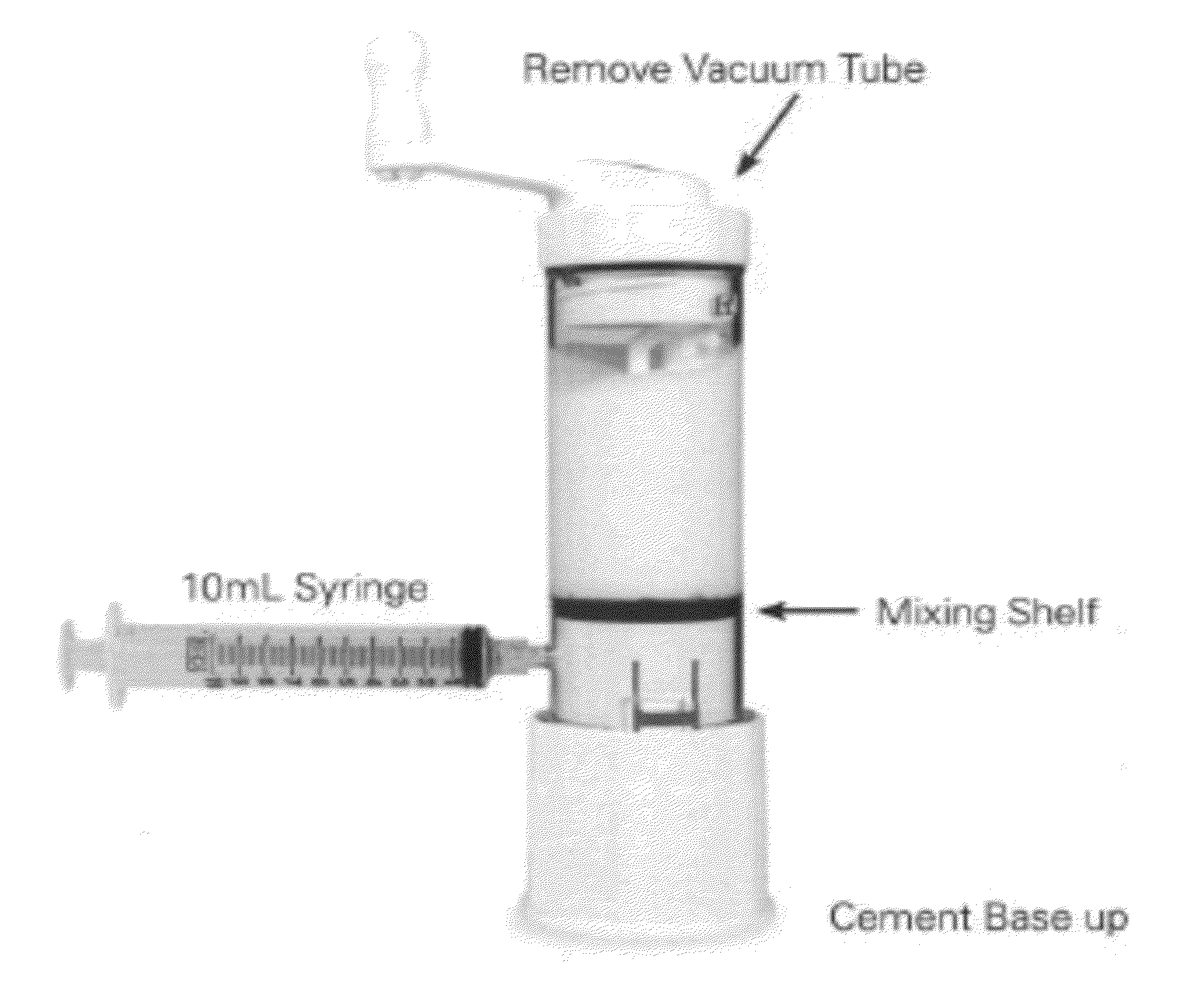 Method of implanting a prosthesis device using bone cement in liquid form