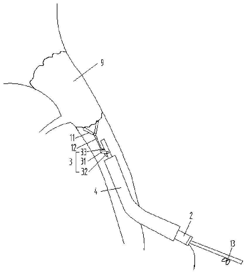 Endovascular biopsy device and biopsy system