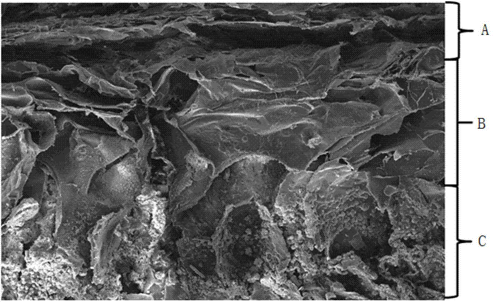 Collagen basal bone cartilage three-layer compound and preparation method thereof