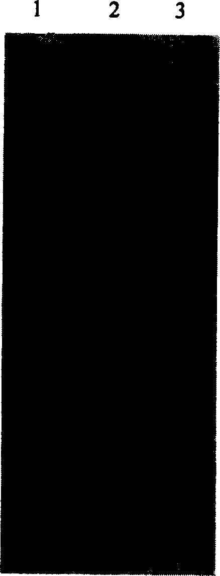 Lumbricus kinase of electrophoretical purity and its prepn and use