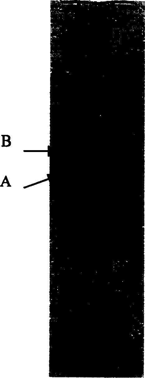 Lumbricus kinase of electrophoretical purity and its prepn and use