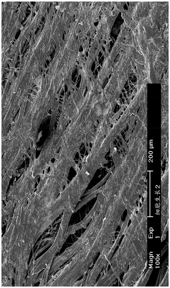 Sutureless Repair of Soft Tissue