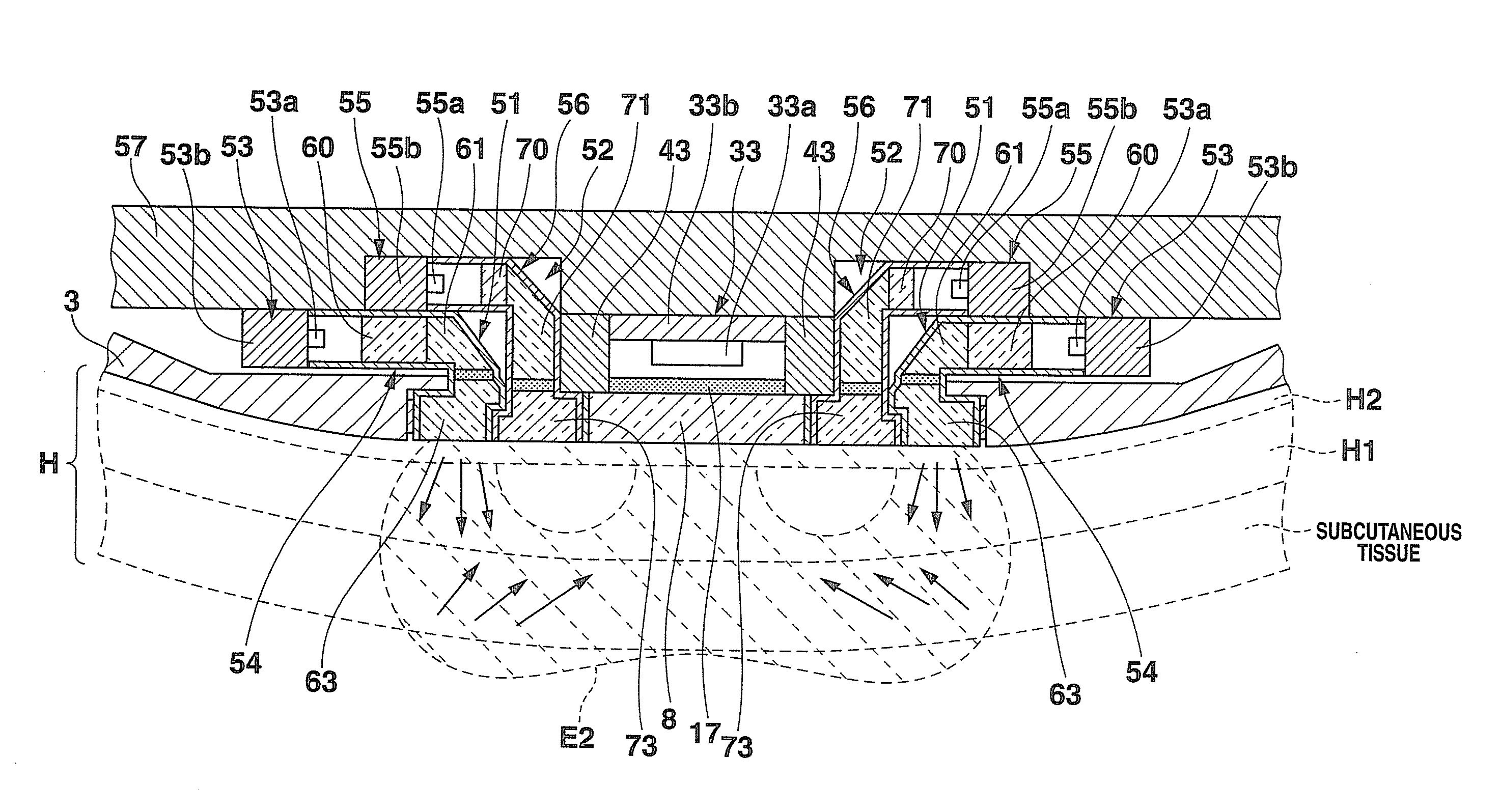 Optical biological information detecting apparatus and optical biological information detecting method