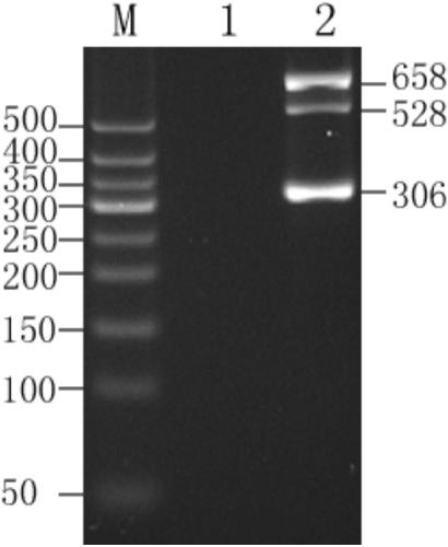 Gene chip, primer set and kit for single-tube detection of non-deletion alpha-thalassemia and beta-thalassemia