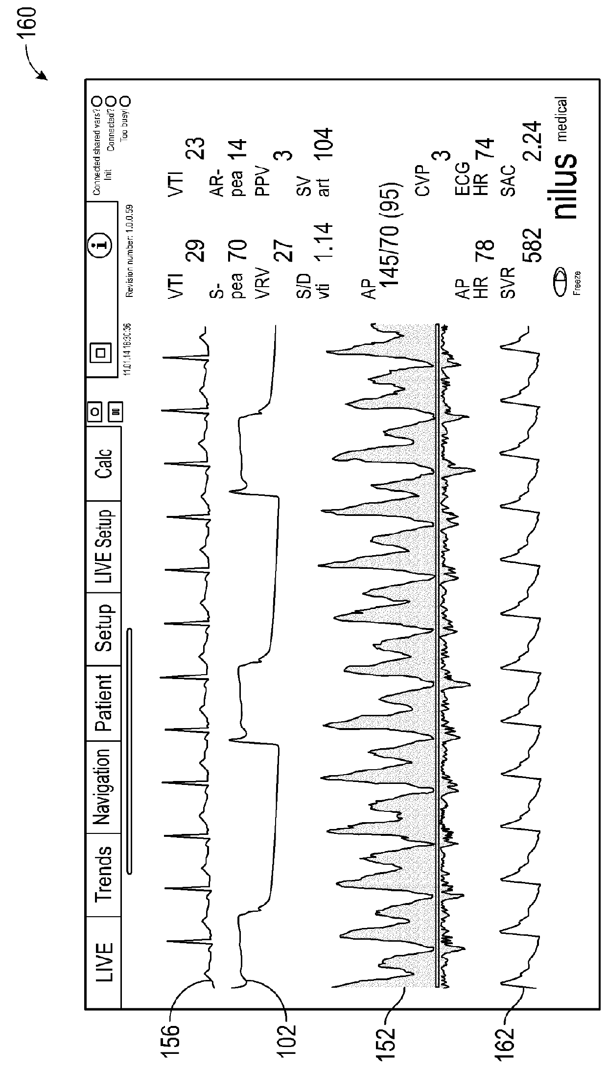 Hemodynamic monitoring device and methods of using same