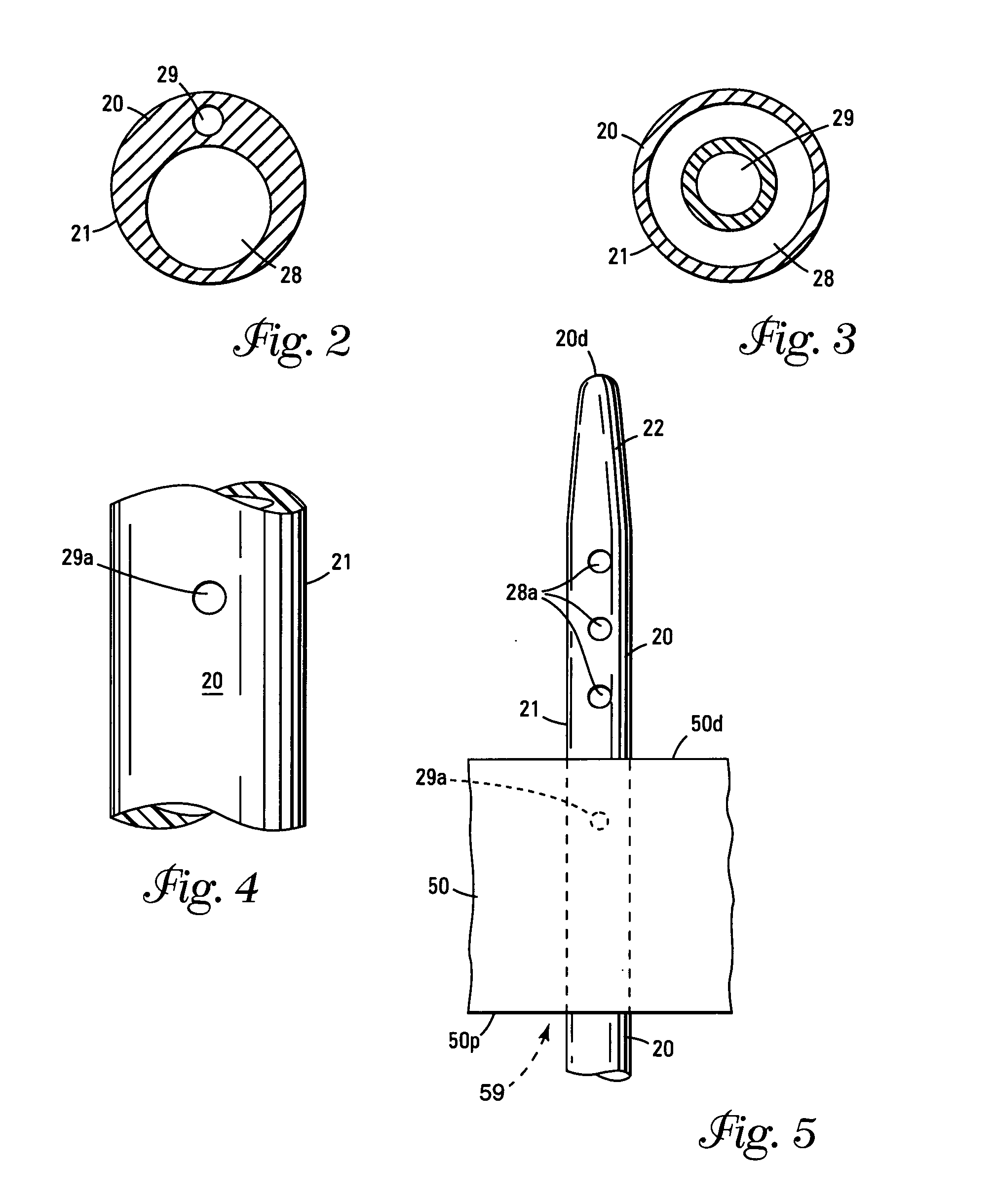 Esophageal balloon catheter