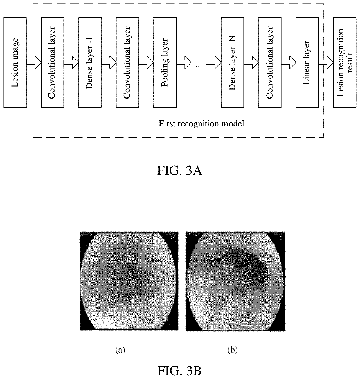 Method, apparatus, system, and storage medium for recognizing medical image