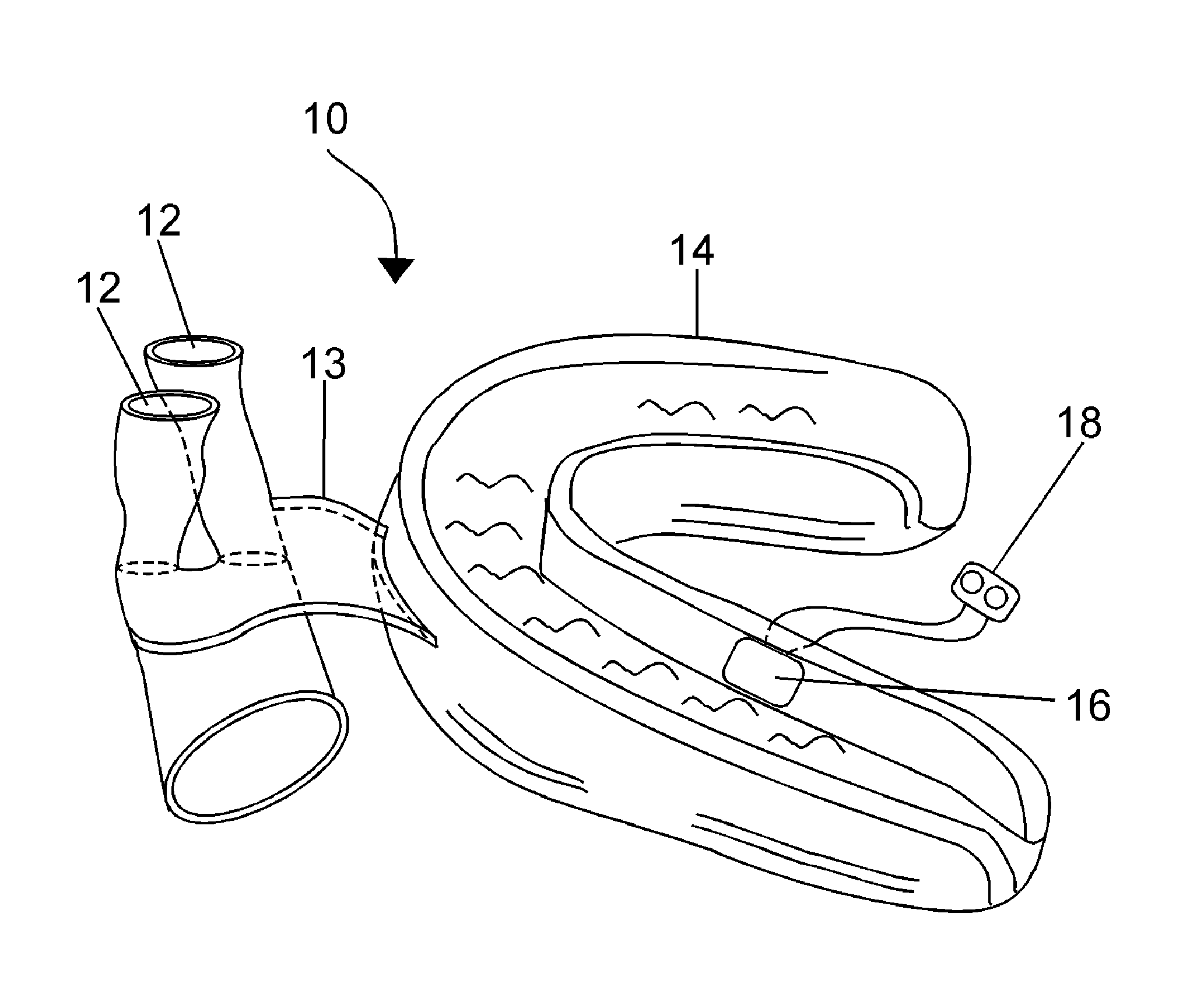 Stimulator combined with an intranasal respiratory method and device for improved breathing