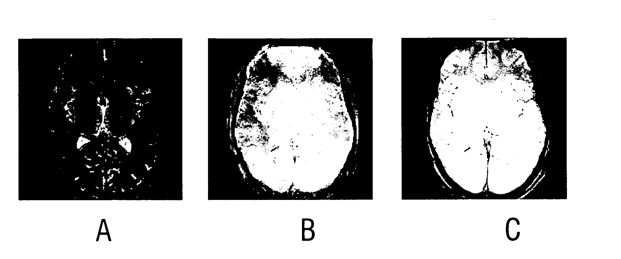 Magnetic resonance imaging with improved imaging contrast