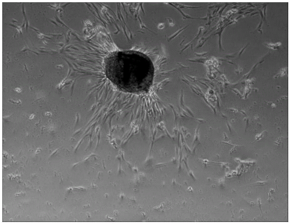 Preparation method of deciduous tooth pulp mesenchymal stem cells