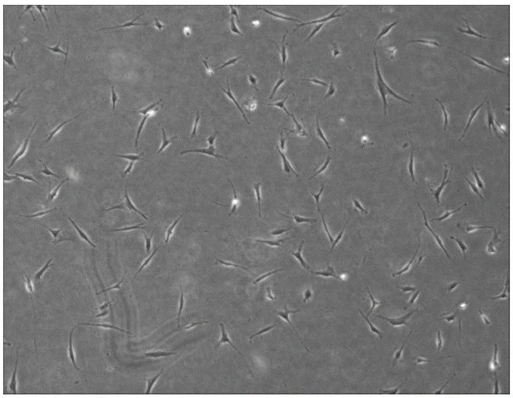 Preparation method of deciduous tooth pulp mesenchymal stem cells