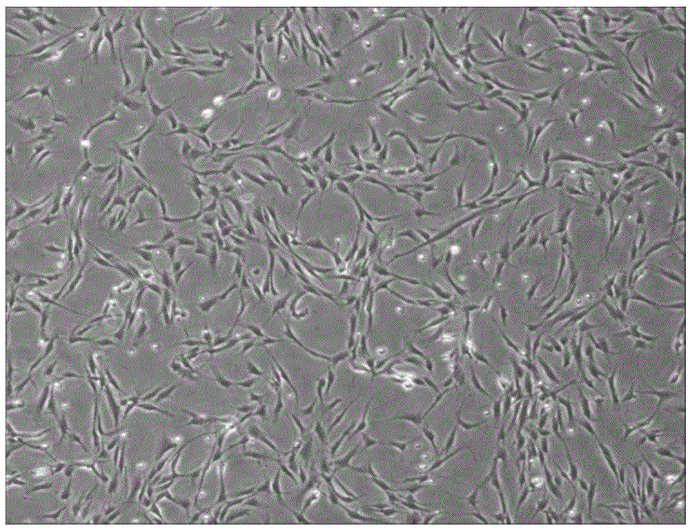 Preparation method of deciduous tooth pulp mesenchymal stem cells