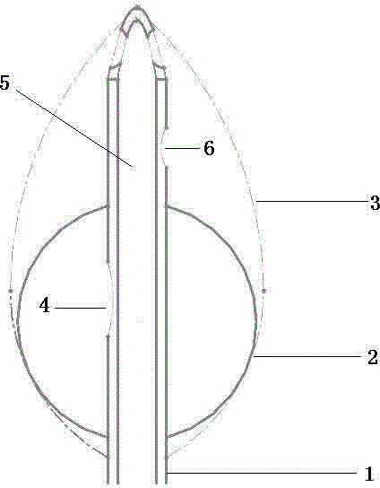 Bladder irrigation anti-blocking catheter