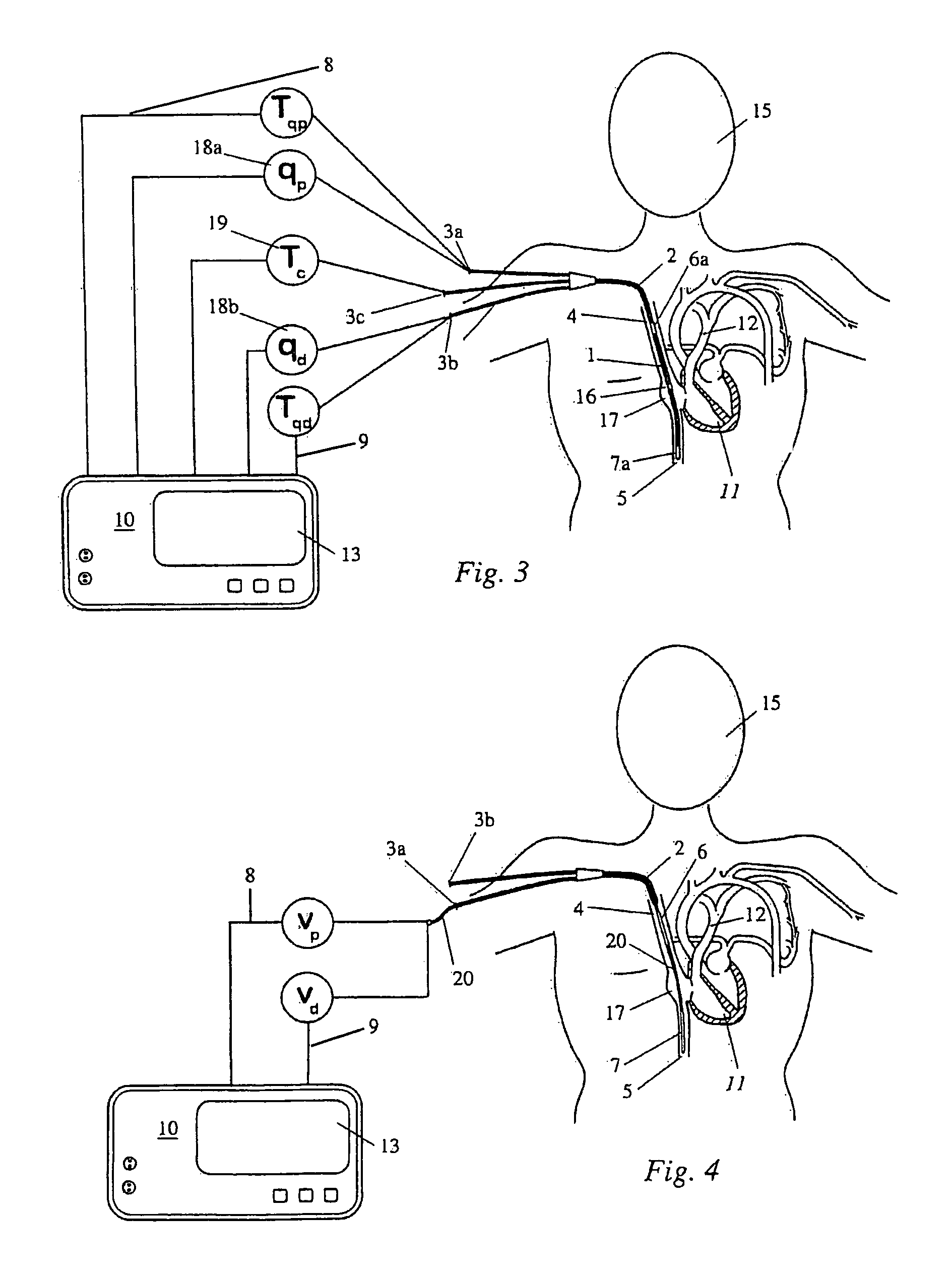 Central venous catheter assembly for measuring physiological data for cardiac output determination and method of determining cardiac output