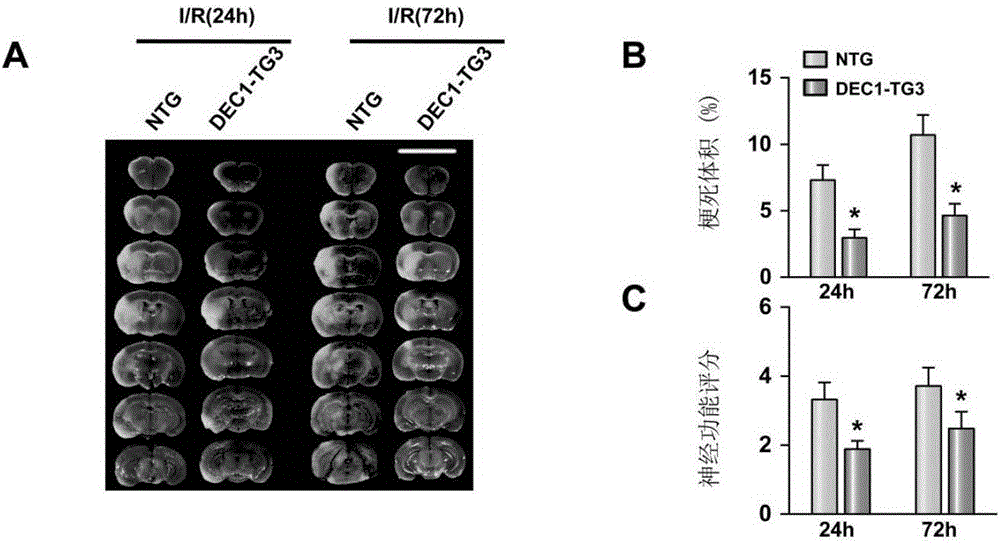 Application of differentiated embryonic cartilage development gene 1 in cerebral stroke disease