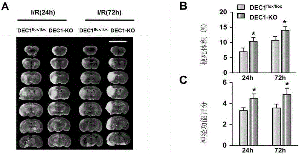 Application of differentiated embryonic cartilage development gene 1 in cerebral stroke disease