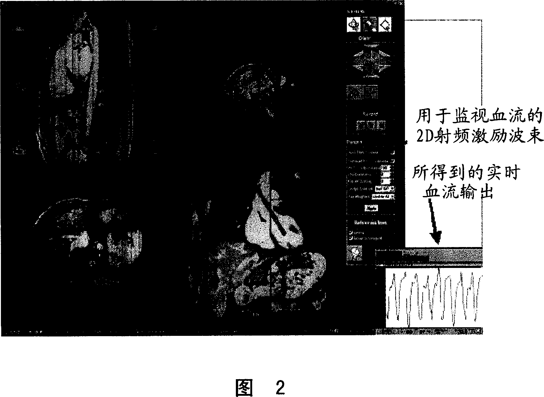 System and method for image based physiological monitoring of cardiovascular function