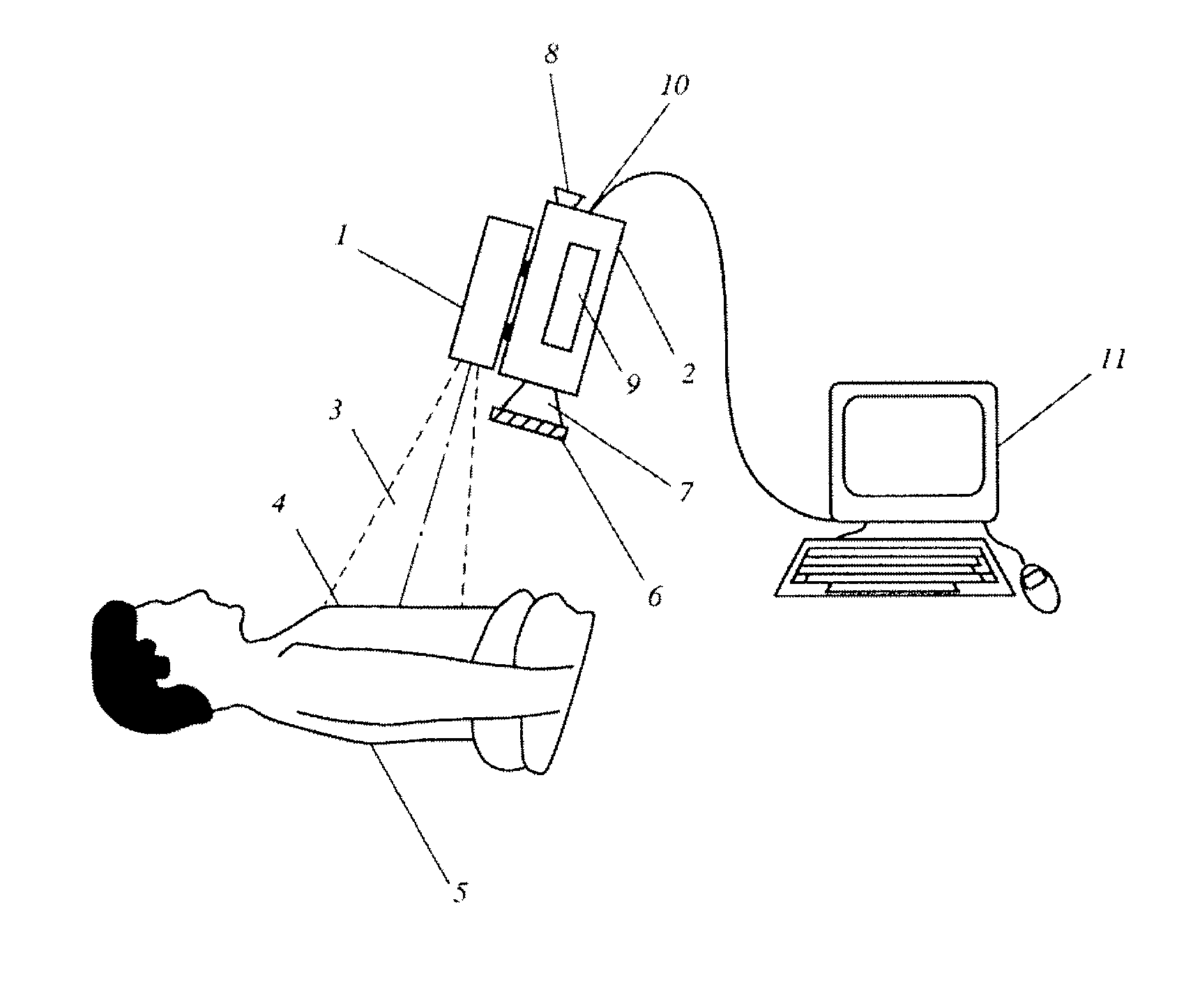 Method for evaluating blush in myocardial tissue