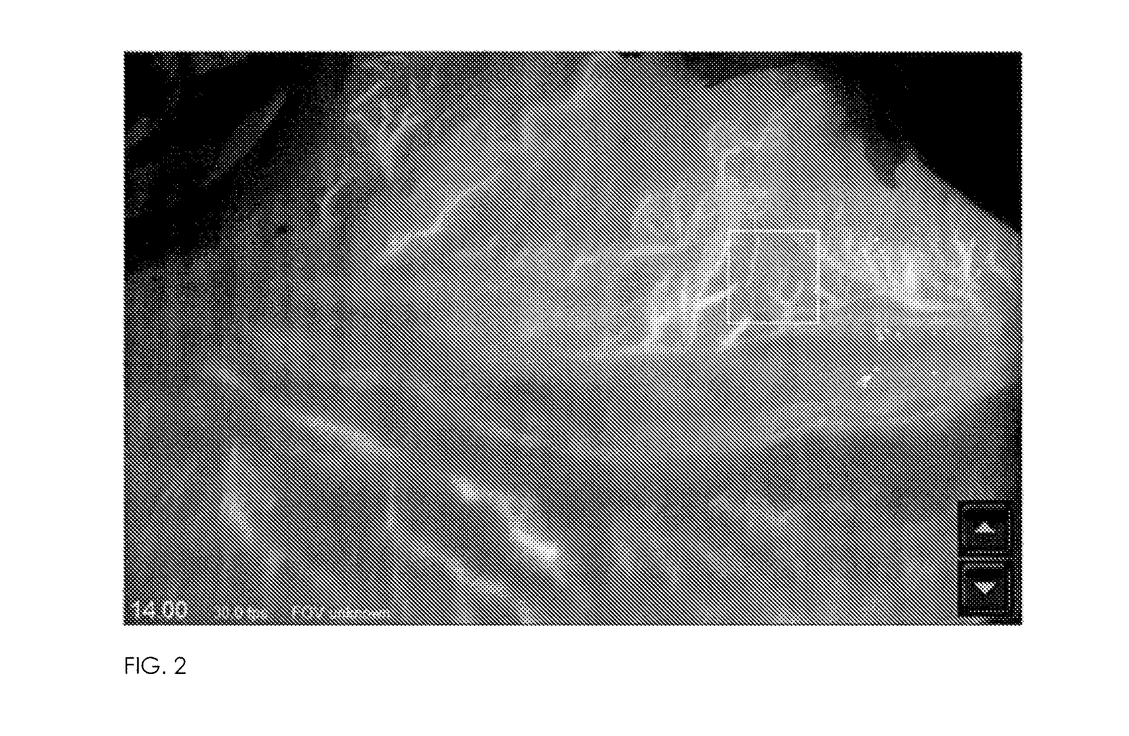 Method for evaluating blush in myocardial tissue