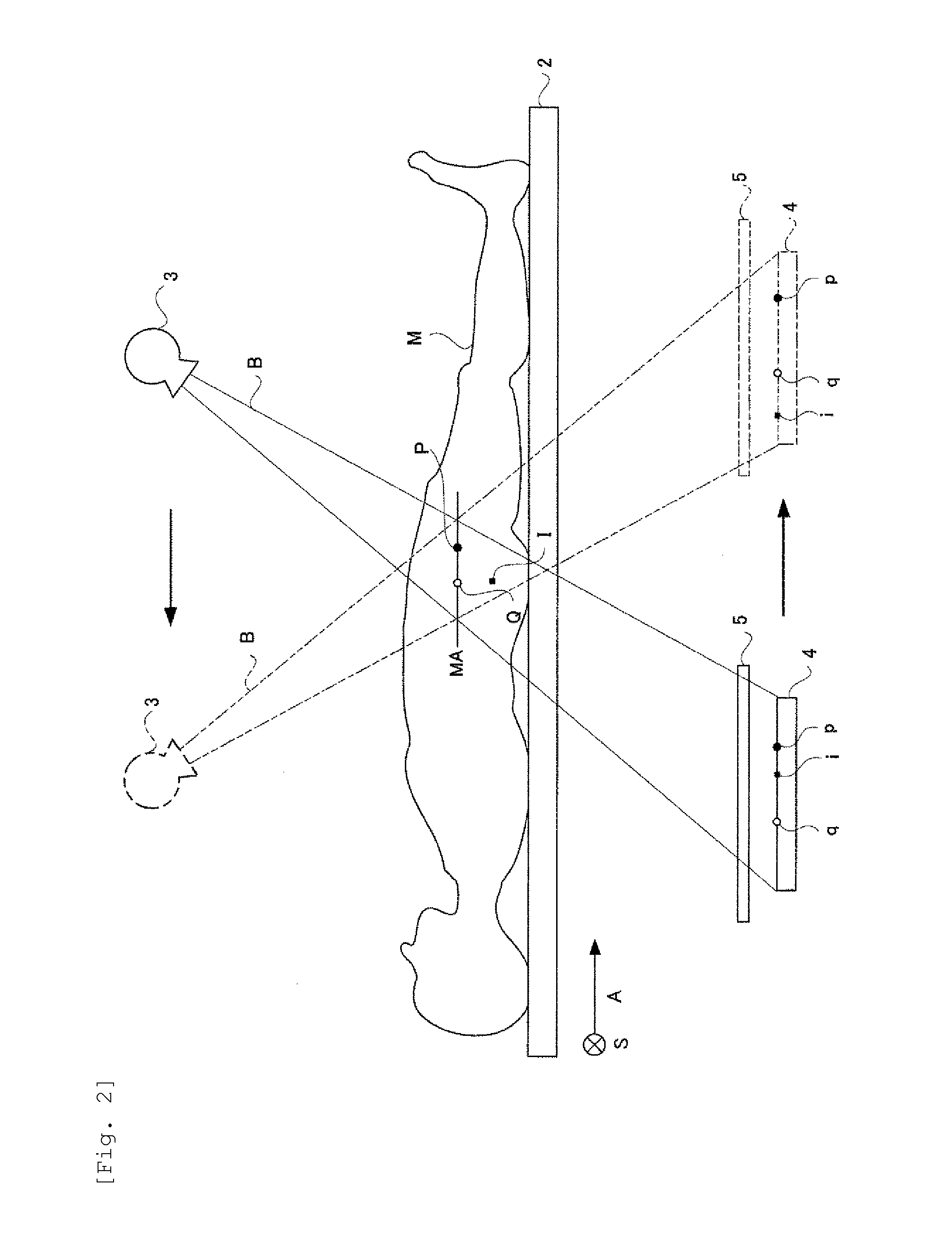 Trabecular bone analyzer