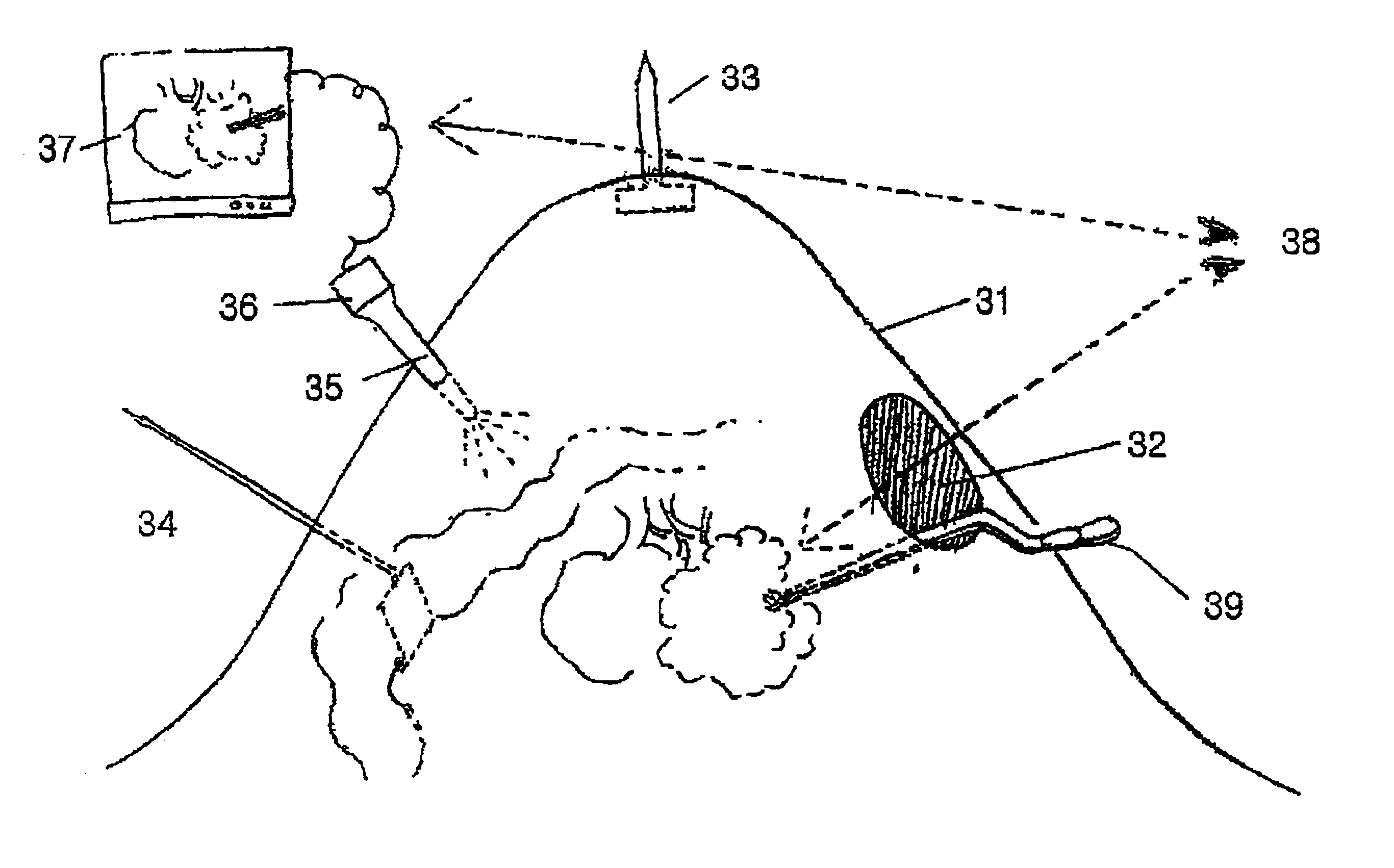 Surgical instruments and method for creating anatomic working space in minilaparotomy procedure