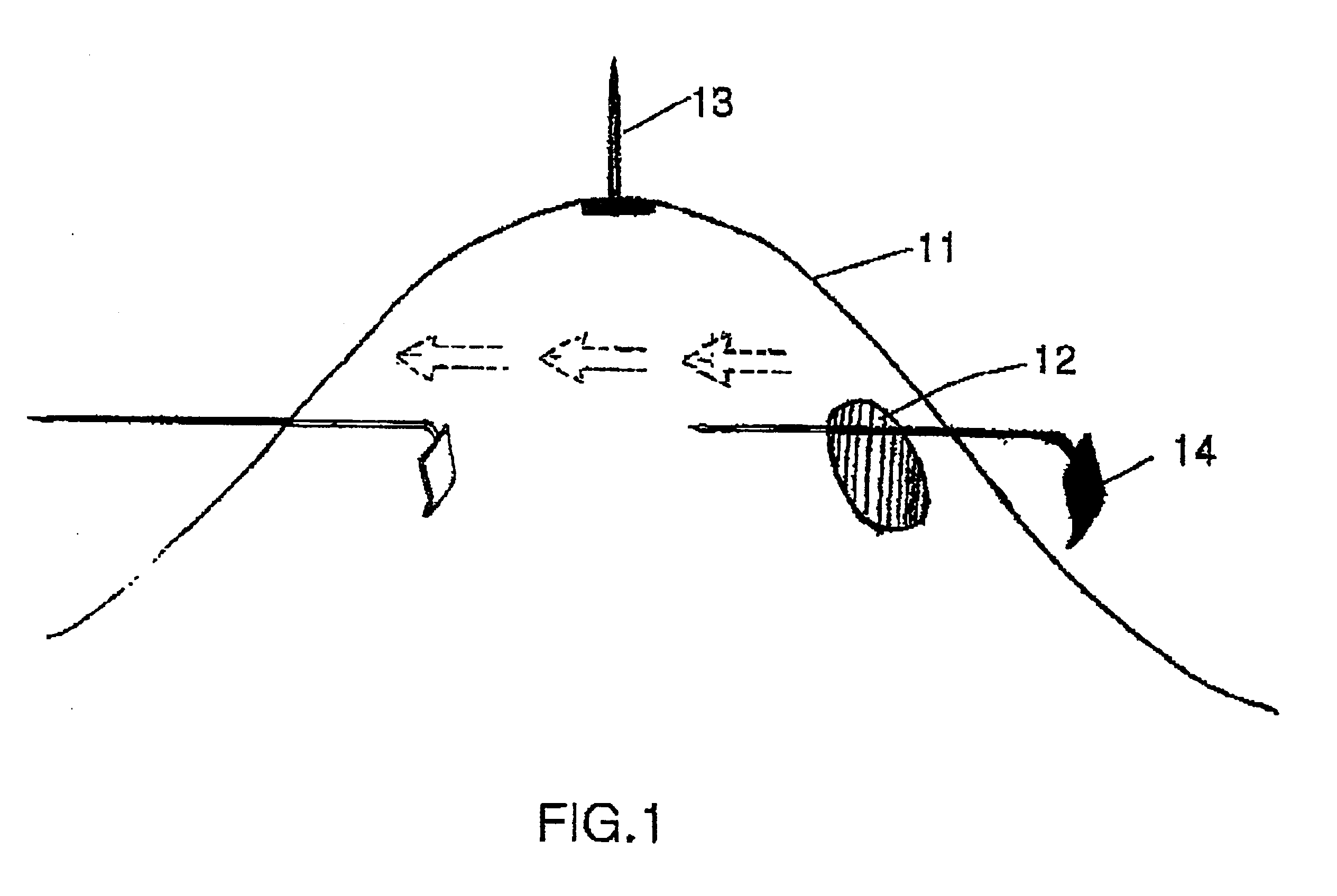 Surgical instruments and method for creating anatomic working space in minilaparotomy procedure