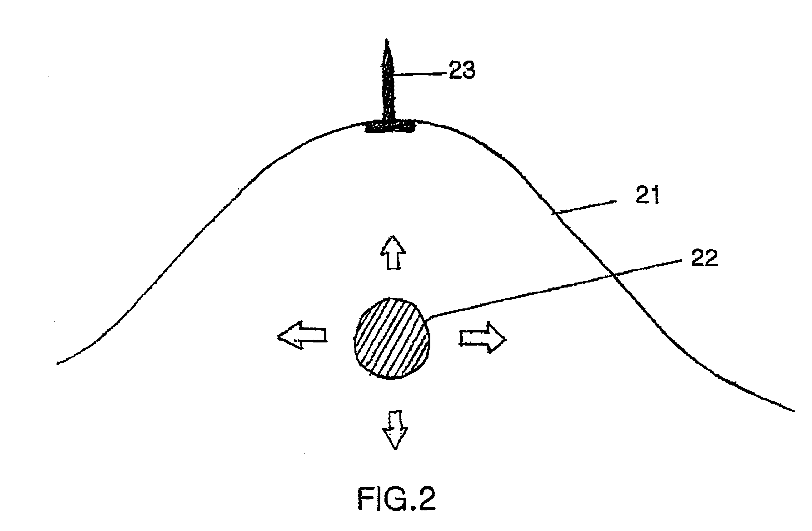 Surgical instruments and method for creating anatomic working space in minilaparotomy procedure