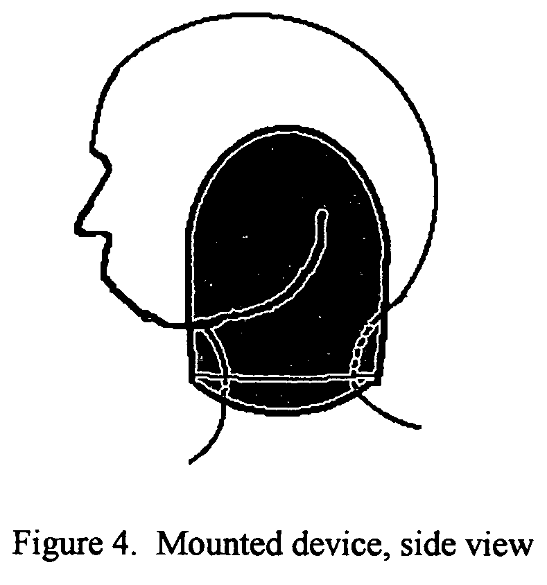 Device to prevent brachial plexus injury during childbirth