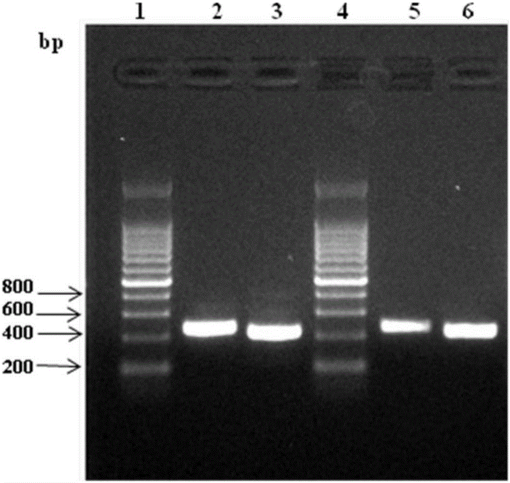 Anti-human-CPR (C reactive protein) antibody and application thereof