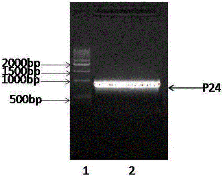 Anti-human-CPR (C reactive protein) antibody and application thereof