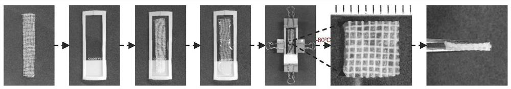 A chitosan-based gauze dressing loaded with metal ions and preparation method thereof