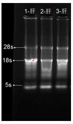 Primers, kits and methods for RT-qPCR detection of liver purine nucleoside phosphatase PNP gene transcription level in macaques