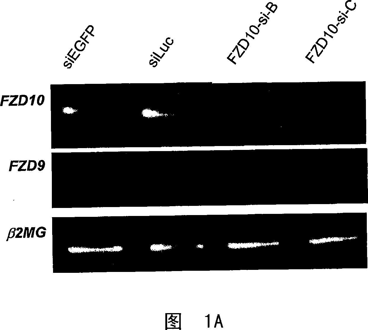 Method for treating synovial sarcoma using sirna for fzd10