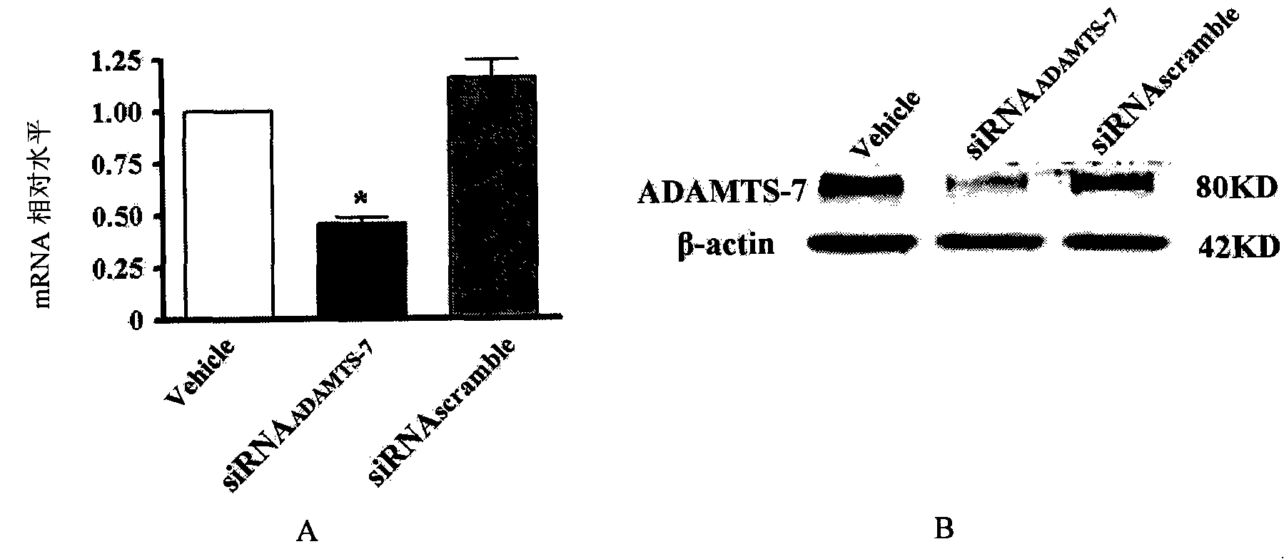 Small numerator interference RNA for inhibiting vascellum endometrial hyperplasia