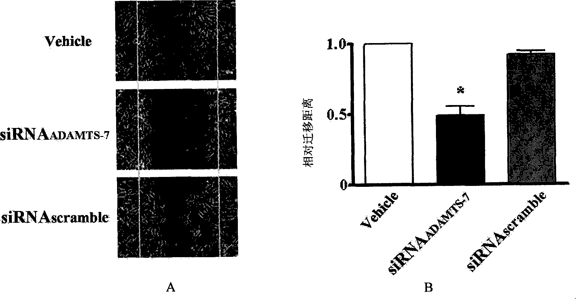 Small numerator interference RNA for inhibiting vascellum endometrial hyperplasia