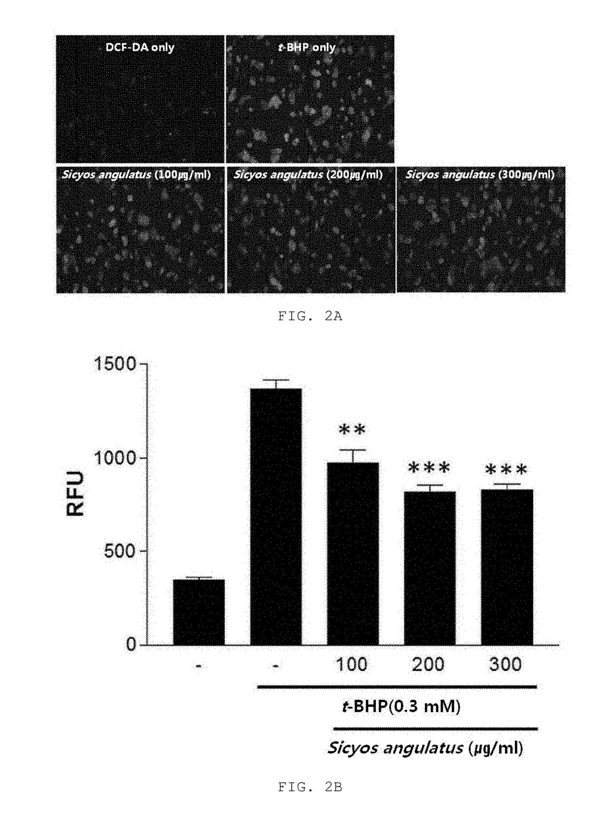 Composition for treating or preventing liver diseases, containing sicyos angulatus extract as active ingredient